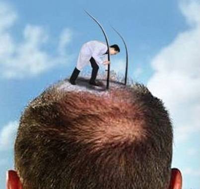 新疆有植發的嗎 新疆人植發要去哪?