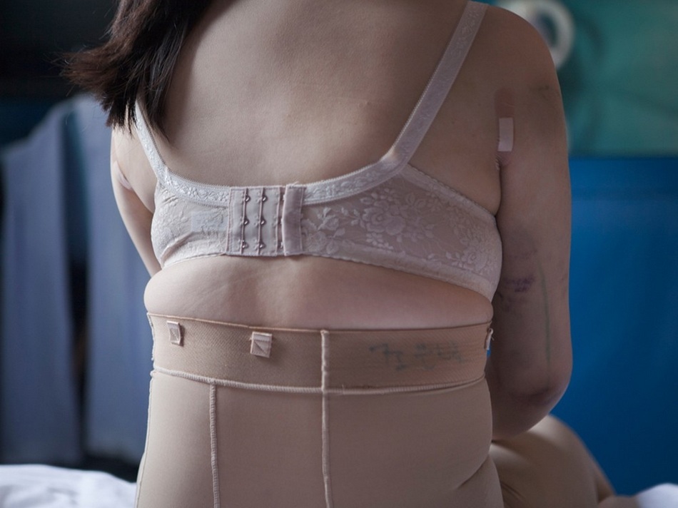 韓國女子整容術后的生活(組圖)